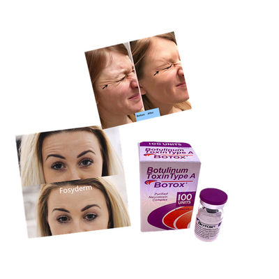 Odorless Protein Botulinum Toxin Neutral PH For Enhanced Stability